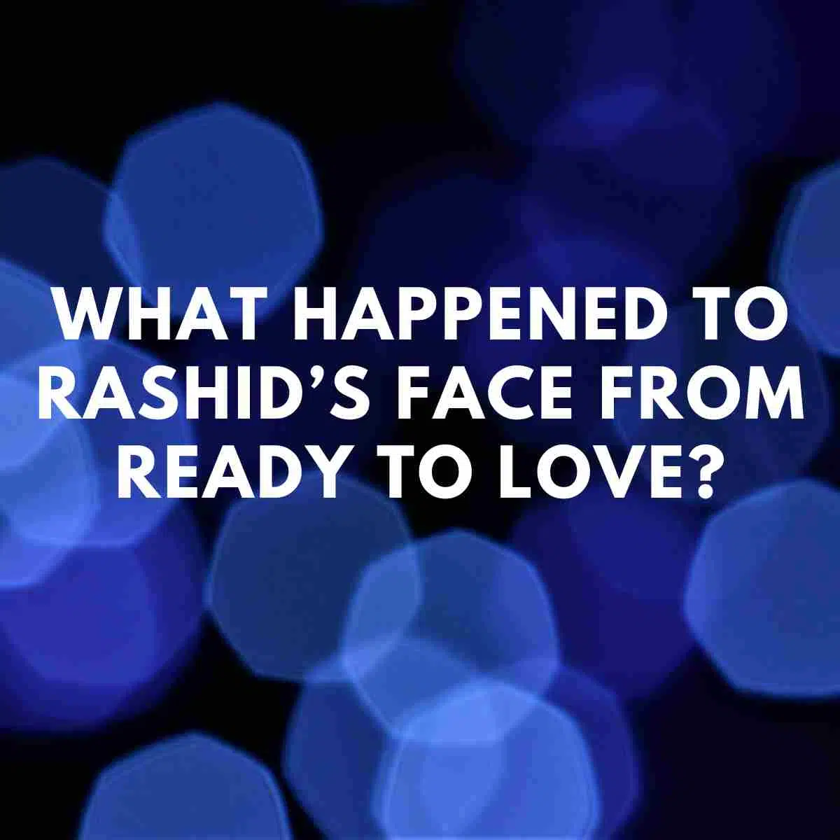 What happened to Rashid’s face from Ready to Love